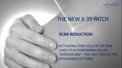 Reduce the appearance of scars with Lifewave phototherapy X-39 patches